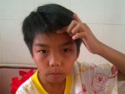 Tin tức - CA xã “bị tố đánh HS lớp 7 nhập viện” xin nghỉ dài hạn