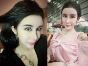 Làm đẹp - Cô gái 15 tuổi mặt cứng đờ vì thẩm mỹ quá đà