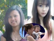 Làm đẹp - Những tình huống 'dở khóc, dở cười' sau phẫu thuật thẩm mỹ