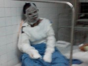 Tin tức - Người vợ tự thiêu vì chồng bạo hành đã qua đời