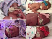 Bà bầu - Kỷ lục: Trong vòng 4 phút, mẹ sinh 5 con gái