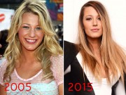 Làm đẹp - Ngôi sao Gossip Girl trẻ đẹp hơn 10 năm trước