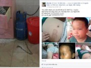 Tin tức - Vụ "bé trai bị bạo hành": "Tôi xích chó chứ không xích con"