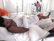 Tin tức - Thảm cảnh người phụ hồ bị điện giật cháy cả hai tay