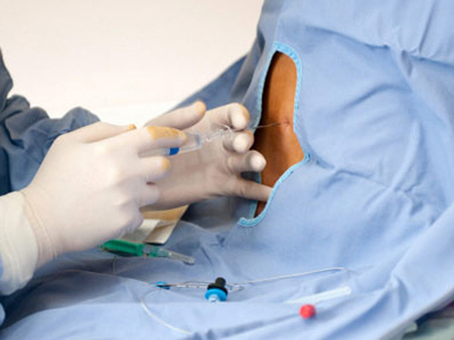 Gây tê ngoài màng cứng và 8 điều cần biết