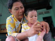 Tin tức - Bà đau đớn vì cháu bị 'vu oan' đổ nước sôi vào người để ăn xin