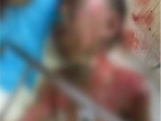 Tin tức - TQ: Bé trai đi tiểu bên đường bị điện giật cháy người