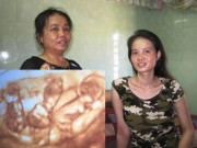 Tin tức - Gặp cô gái trẻ mang 4 bào thai tự nhiên cực hiếm