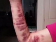 Sức khỏe - Người phụ nữ mắc bệnh lạ, máu chảy không kiểm soát từ mắt và miệng