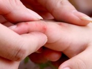 Tin tức - Bé gái 3 tuổi tử vong do bệnh tay chân miệng