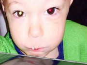 Làm mẹ - Chuyên gia mách cách nhận biết bệnh của con qua đôi mắt