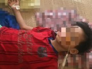 Tin tức - Uống nhầm axit, bé trai 7 tuổi phải cắt bỏ 2/3 dạ dày