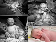 Bà bầu - Mở cánh cửa phòng đẻ, xem trực tiếp một ca sinh mổ