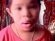 Tin tức - Môi bé gái biến dạng vì ngậm đồ chơi Trung Quốc