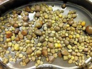 Tin tức - Kinh hoàng người đàn ông mang 420 viên sỏi trong thận