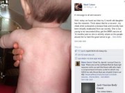 Tin tức - Canada: Cha gửi thư cho 'hội phản đối tiêm chủng' khi con bị sởi