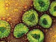 Tin tức - Hàn Quốc đã có 10 ca tử vong, 122 người nhiễm MERS