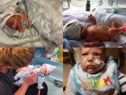 Làm mẹ - Bộ ảnh 100 ngày chuyển biến kỳ diệu của em bé sinh non 4 tháng