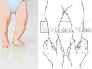 Làm mẹ - Sai lầm tai hại từ thói quen bế cắp nách trẻ nhỏ