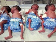 Bà bầu - Sốc: Ngỡ mang thai một, mẹ đẻ thường 5 con