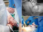 Bà bầu - Ảnh chân thực bên trong bụng mẹ khi sinh mổ