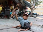 Tin tức - Chuyện đời đẫm nước mắt của người đàn bà có 15 năm chăm sóc “sọ dừa”