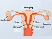 Bà bầu - Cô gái có 2 âm đạo, 2 tử cung tiết lộ chuyện mang thai
