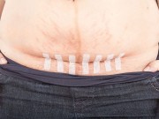 Bà bầu - 12 điều mẹ sinh mổ phải tránh