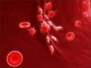 Tin tức - Giáo sư đầu ngành hướng dẫn chăm sóc bệnh máu khó đông