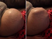 Bà bầu - Kinh ngạc với chuyển động của thai nhi dưới làn da bụng mẹ