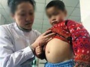 Bà bầu - TQ: Bé 4 tuổi mang thai khiến cha mẹ sốc nặng