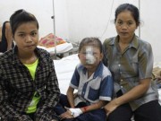 Tin tức - Bé trai bị "bệnh lạ" ăn mòn khuôn mặt đã qua đời