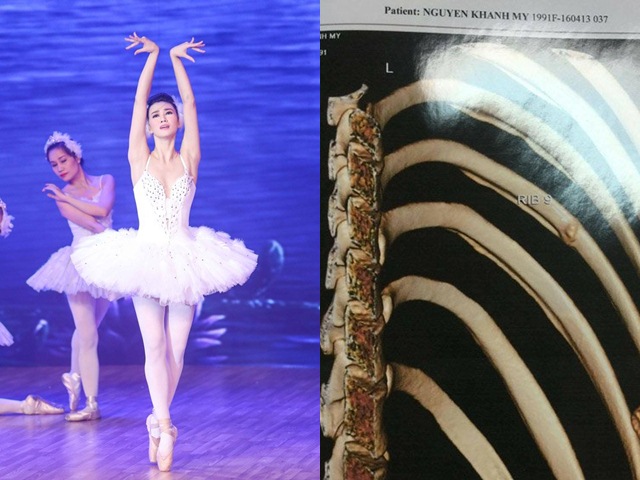 Khánh My dập tin đồn giả gãy xương, đòi tình thương