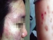 Tin tức - TQ: Gần 500 học sinh phát bệnh vì trường ô nhiễm