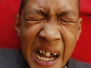 Làm mẹ - Rùng mình lễ cắt bao quy đầu cho 300 cậu bé tại Philippines