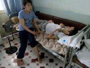 Tin tức - Cảm phục cô gái “chân voi” chăm sóc chàng trai bại liệt