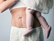 Bà bầu - 9 điều “nhức nhối” chẳng mẹ nào mong đợi sau sinh