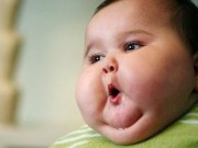 Làm mẹ - Trẻ thừa cân béo phì và những cơ hội bị đánh mất