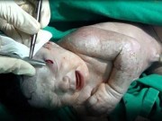 Làm mẹ - 7 em bé gây kinh ngạc vì gặp "đại họa" vẫn sống sót kì diệu