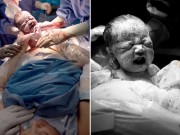 Bà bầu - Mẹ dũng cảm sinh 6 con đều bằng phương pháp đẻ mổ