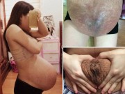 Bà bầu - Hình ảnh bụng bầu rỉ máu khiến nam giới cũng phải xót xa