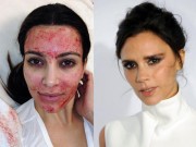 Làm đẹp - Phát hoảng vì những cách làm đẹp kinh dị của sao