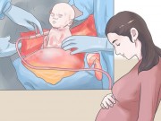 Bà bầu - 8 điều kiêng kị sau sinh mổ mẹ phải biết