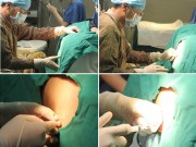 Bà bầu - Mũi tiêm gây tê khi sinh mổ có gây hại gì?