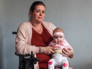 Bà bầu - Bà mẹ ‘sốc nặng’ vì bị cắt bỏ 2 chân sau ca sinh mổ