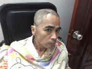 Làng sao - Diễn viên Nguyễn Hoàng phải nhập viện để lắp lại hộp sọ