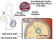 Tin tức - Con đường lây truyền bí mật của Zika từ mẹ sang thai nhi
