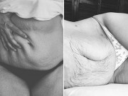 Bà bầu - Ảnh "nổi da gà" về sự hy sinh cơ thể đầy thiêng liêng của mẹ