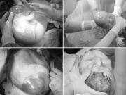 Bà bầu - Ảnh hiếm 80 nghìn ca mới có một về bé chào đời trong bọc ối