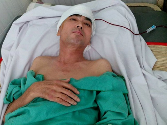 Diễn viên Nguyễn Hoàng dần hồi phục sau ca ghép hộp sọ